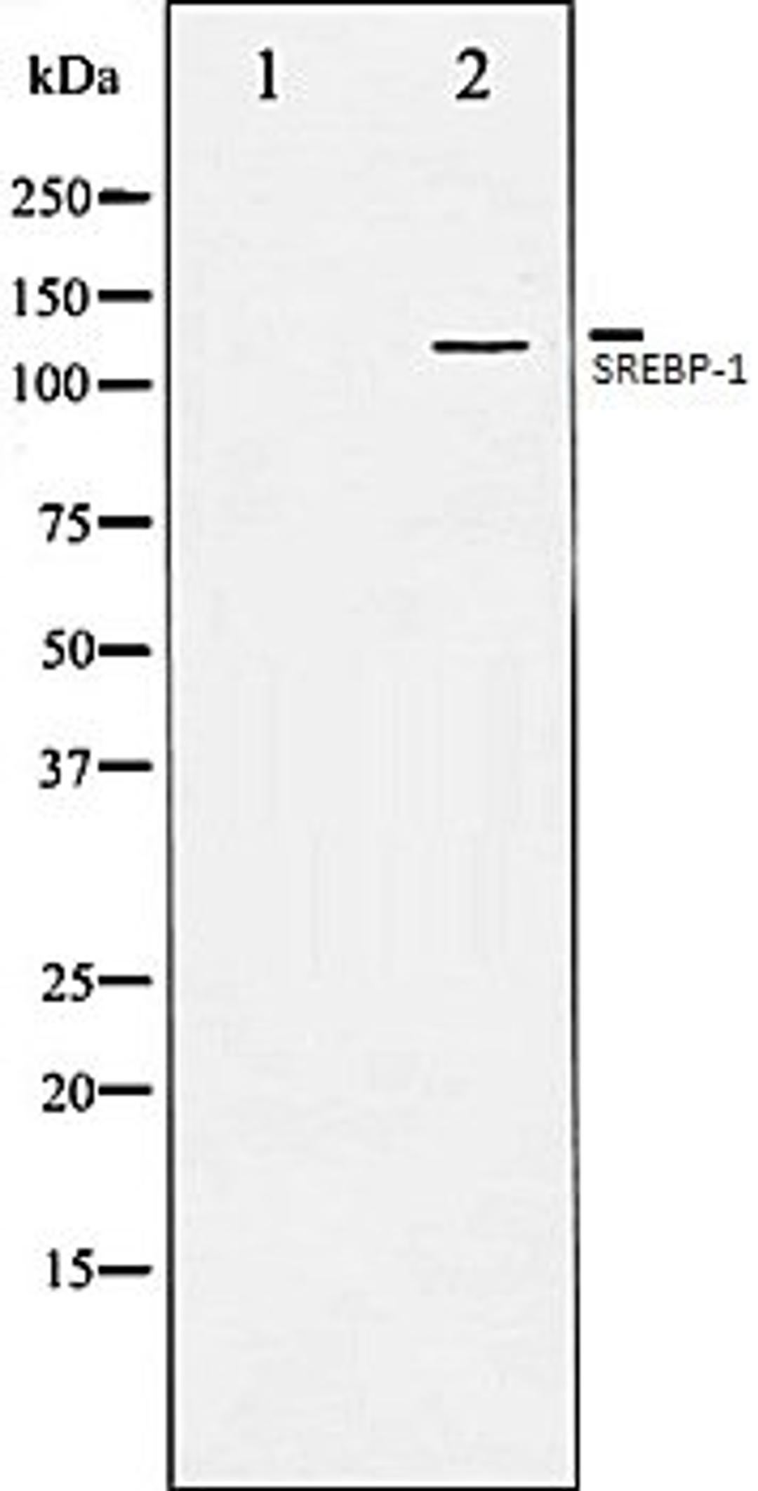 Western blot analysis of JK whole cell lysates using SREBP-1 antibody, The lane on the left is treated with the antigen-specific peptide.