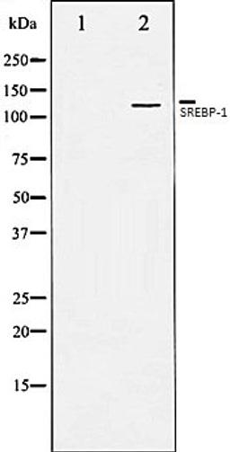 Western blot analysis of JK whole cell lysates using SREBP-1 antibody, The lane on the left is treated with the antigen-specific peptide.