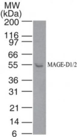 Western Blot: MAGED2 Antibody [NBP2-24694] - Analysis of MAGE-D1/2 in A375 cell lysate using NBP2-24694 at 5 ug/ml.  Goat anti-rabbit Ig HRP secondary antibody and Picotect ECL substrate solution were used for this test.