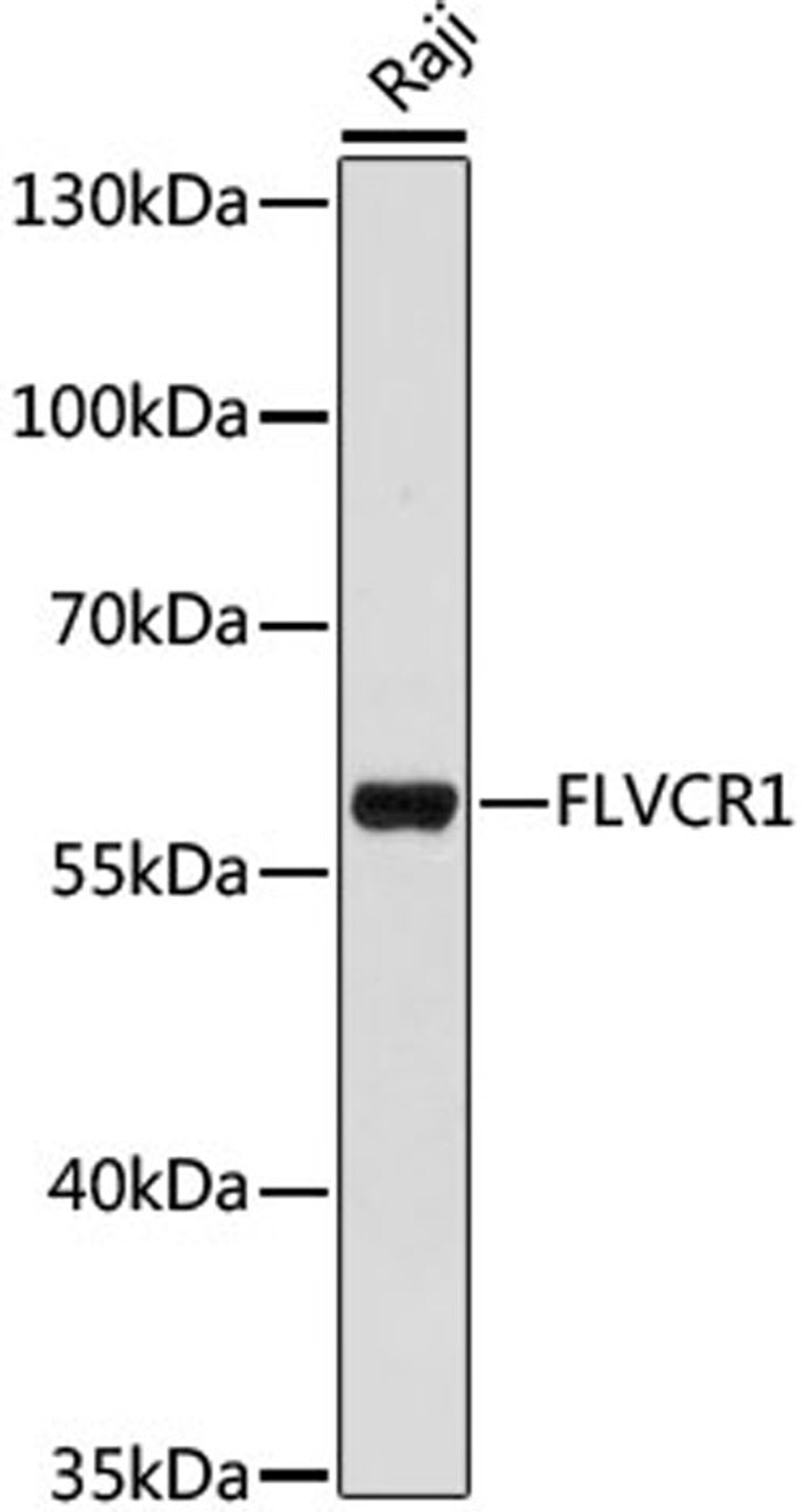 Western blot - FLVCR1 antibody (A15153)