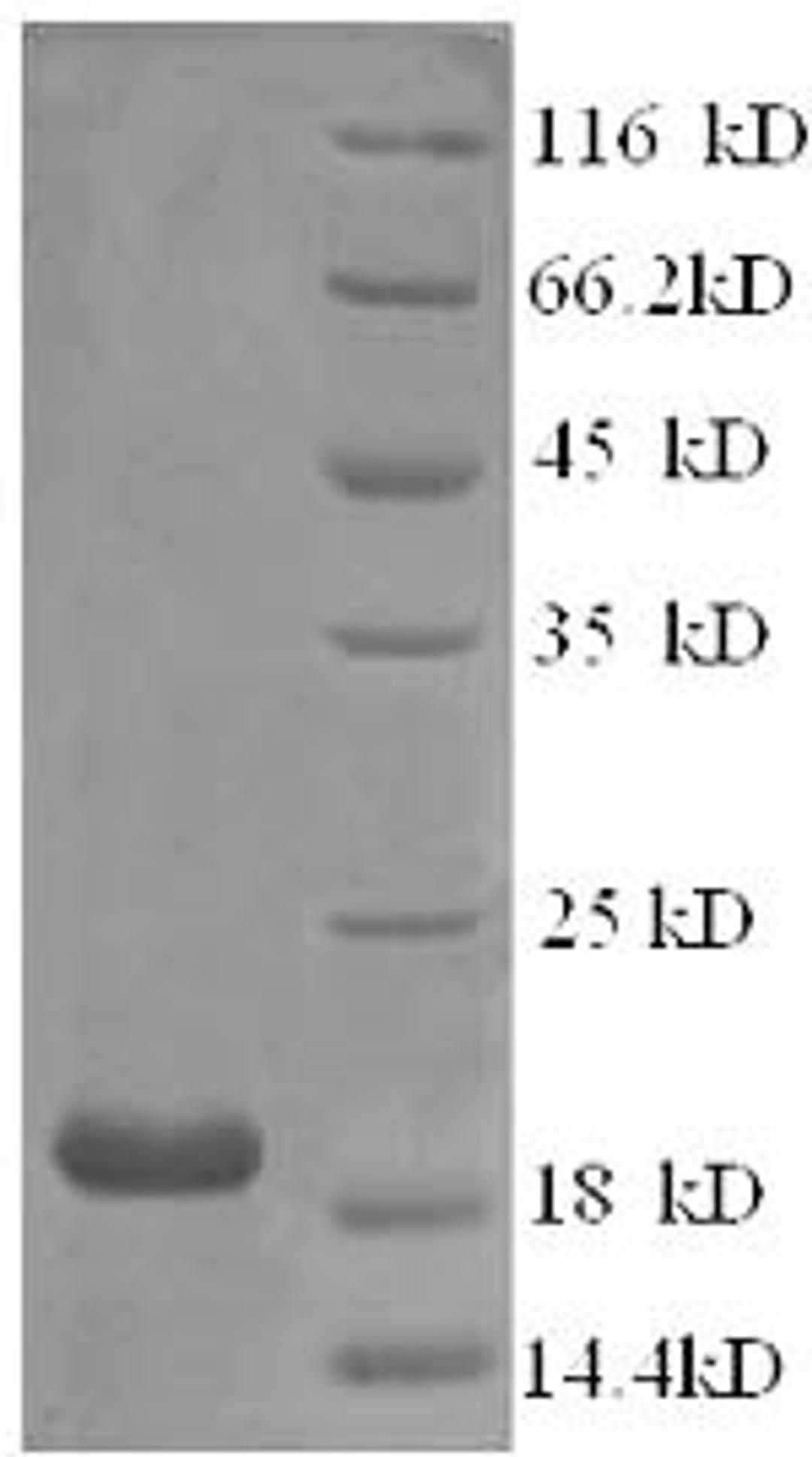 (Tris-Glycine gel) Discontinuous SDS-PAGE (reduced) with 5% enrichment gel and 15% separation gel.