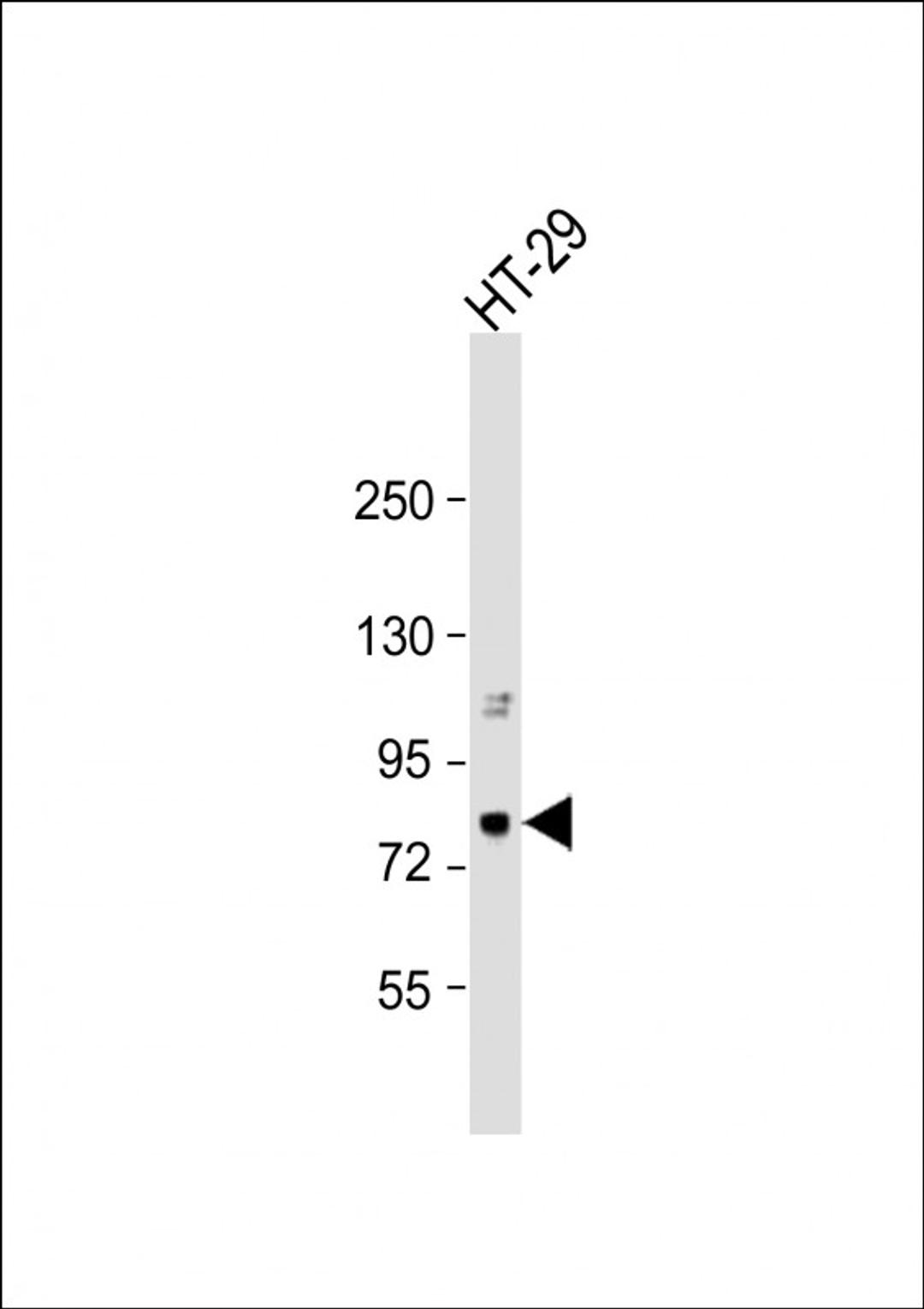 Western Blot at 1:1000 dilution + HT-29 whole cell lysate Lysates/proteins at 20 ug per lane.