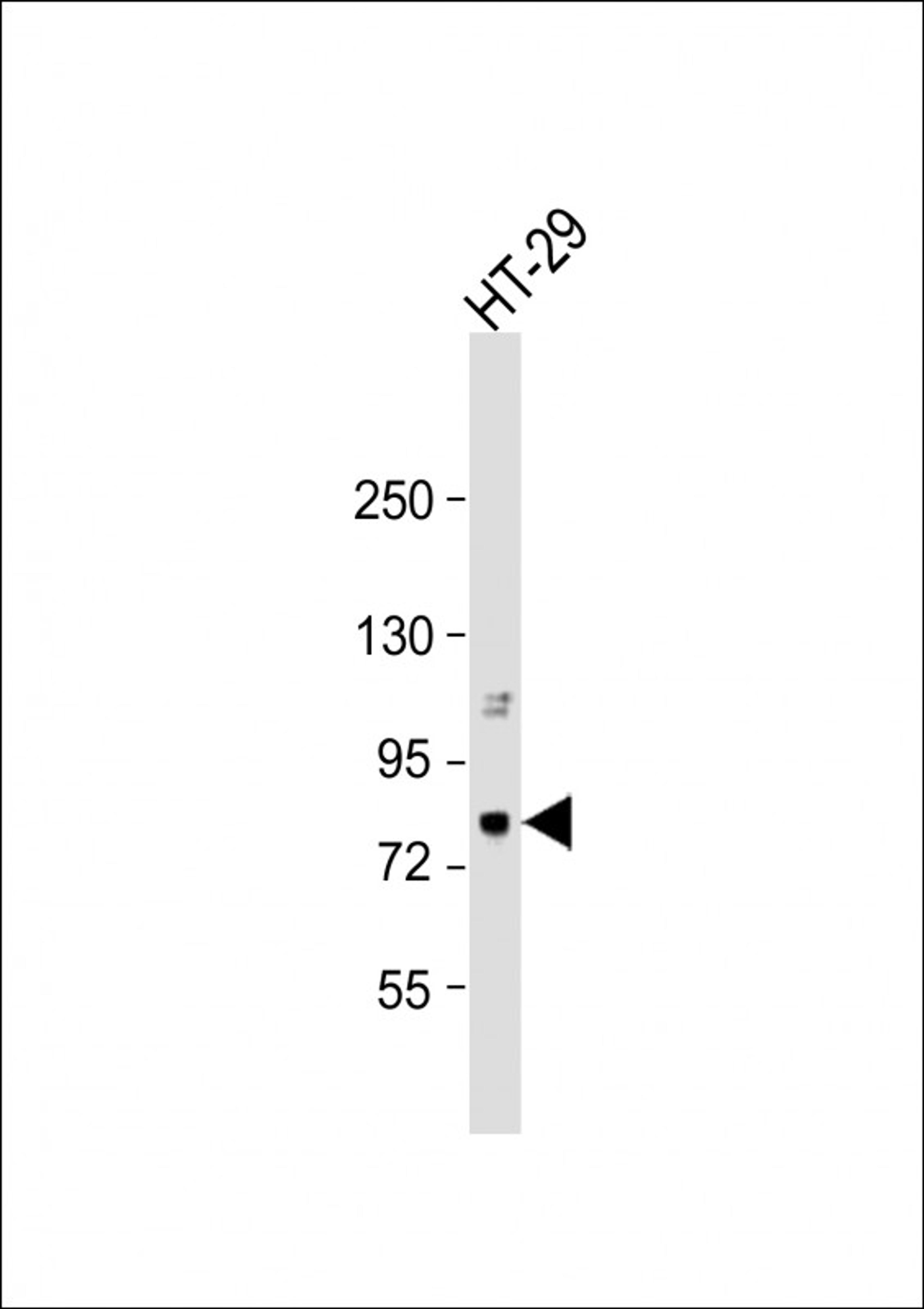 Western Blot at 1:1000 dilution + HT-29 whole cell lysate Lysates/proteins at 20 ug per lane.