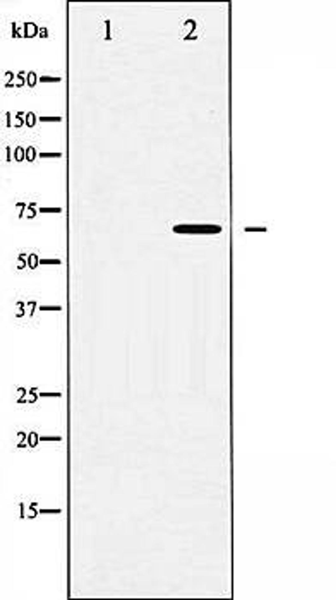 Western blot analysis on 293 treated with Heat shock using phospho-AMPK alpha (Thr172) Antibody,The lane on the left is blocked with the antigen-specific peptide