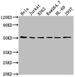 Western Blot. Positive WB detected in: Hela whole cell lysate, Jurkat whole cell lysate, K562 whole cell lysate, Raw264.7 whole cell lysate, HL-60 whole cell lysate, 293T whole cell lysate. All lanes: CSK antibody at 1:2000. Secondary. Goat polyclonal to rabbit IgG at 1/50000 dilution. Predicted band size: 51 kDa. Observed band size: 51 kDa.