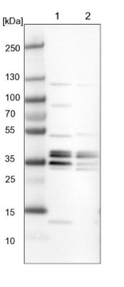 Western Blot: ATP6V1E1 Antibody [NBP2-14335] - Lane 1: NIH-3T3 cell lysate (Mouse embryonic fibroblast cells)<br/>Lane 2: NBT-II cell lysate (Rat Wistar bladder tumour cells)