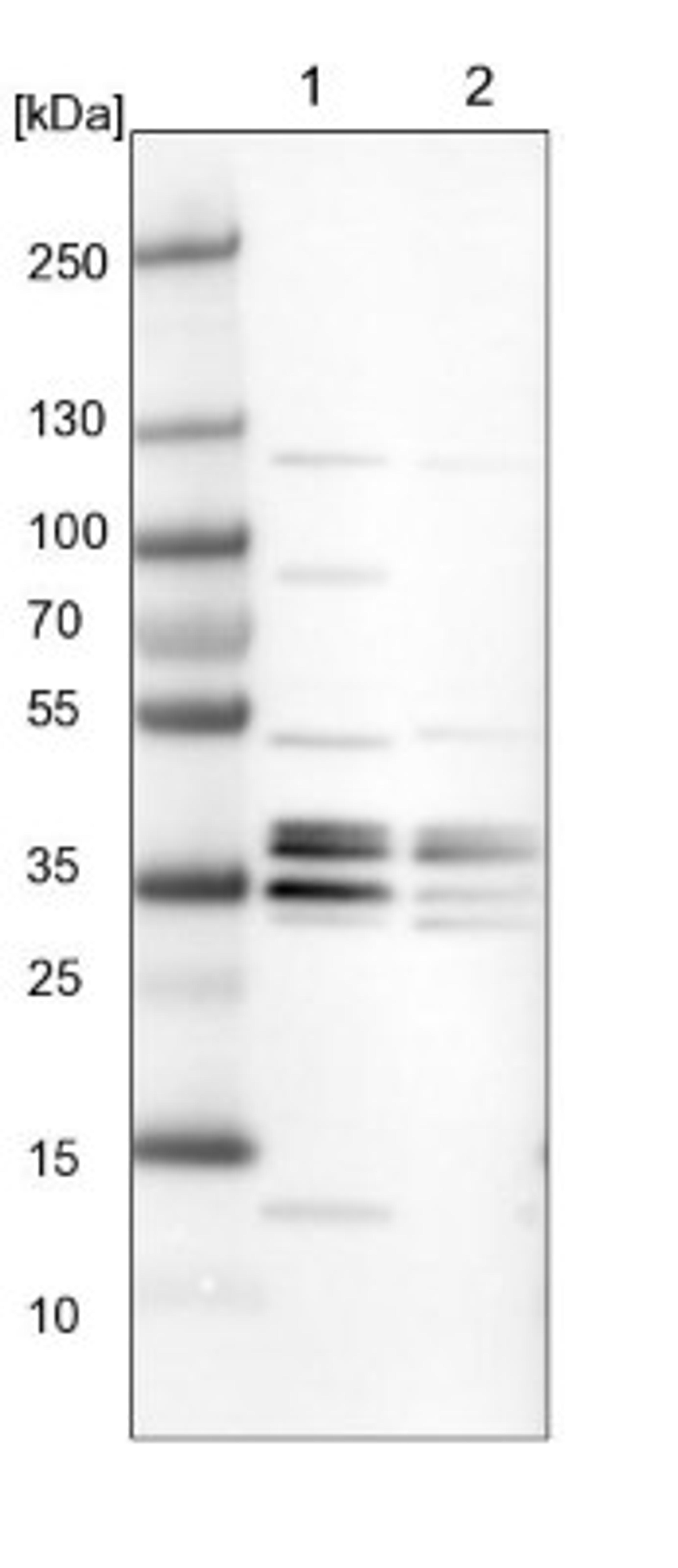 Western Blot: ATP6V1E1 Antibody [NBP2-14335] - Lane 1: NIH-3T3 cell lysate (Mouse embryonic fibroblast cells)<br/>Lane 2: NBT-II cell lysate (Rat Wistar bladder tumour cells)