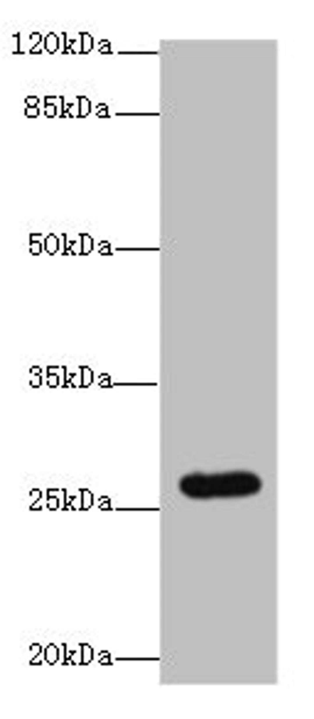 Western blot. All lanes: TMEM217 antibody at 10µg/ml + Jurkat whole cell lysate. Secondary. Goat polyclonal to rabbit IgG at 1/10000 dilution. Predicted band size: 27, 25 kDa. Observed band size: 27 kDa