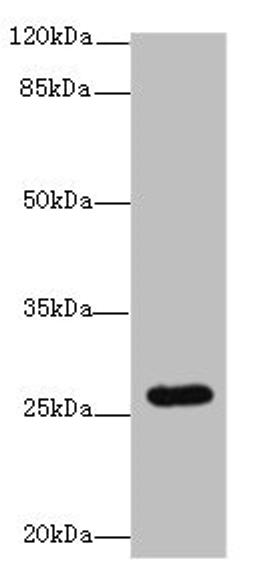 Western blot. All lanes: TMEM217 antibody at 10µg/ml + Jurkat whole cell lysate. Secondary. Goat polyclonal to rabbit IgG at 1/10000 dilution. Predicted band size: 27, 25 kDa. Observed band size: 27 kDa