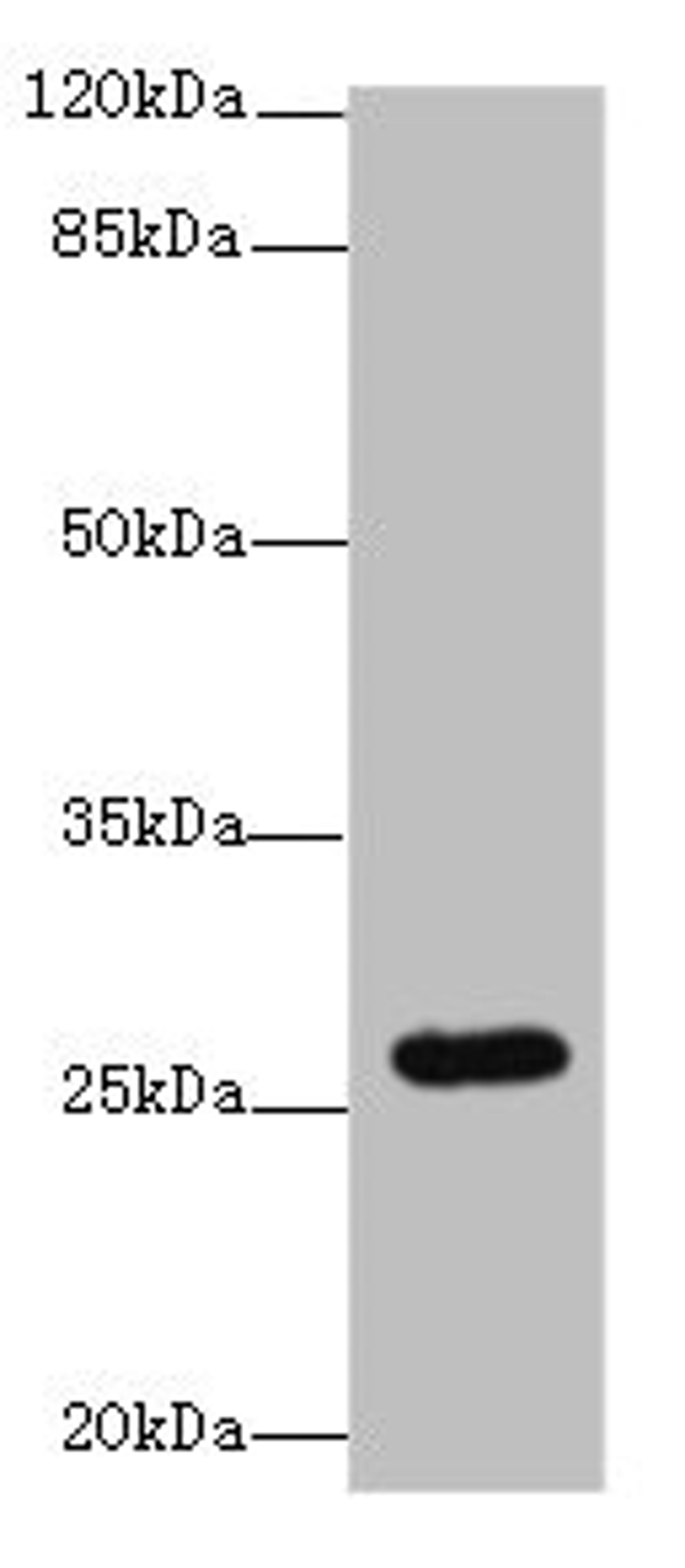 Western blot. All lanes: TMEM217 antibody at 10µg/ml + Jurkat whole cell lysate. Secondary. Goat polyclonal to rabbit IgG at 1/10000 dilution. Predicted band size: 27, 25 kDa. Observed band size: 27 kDa