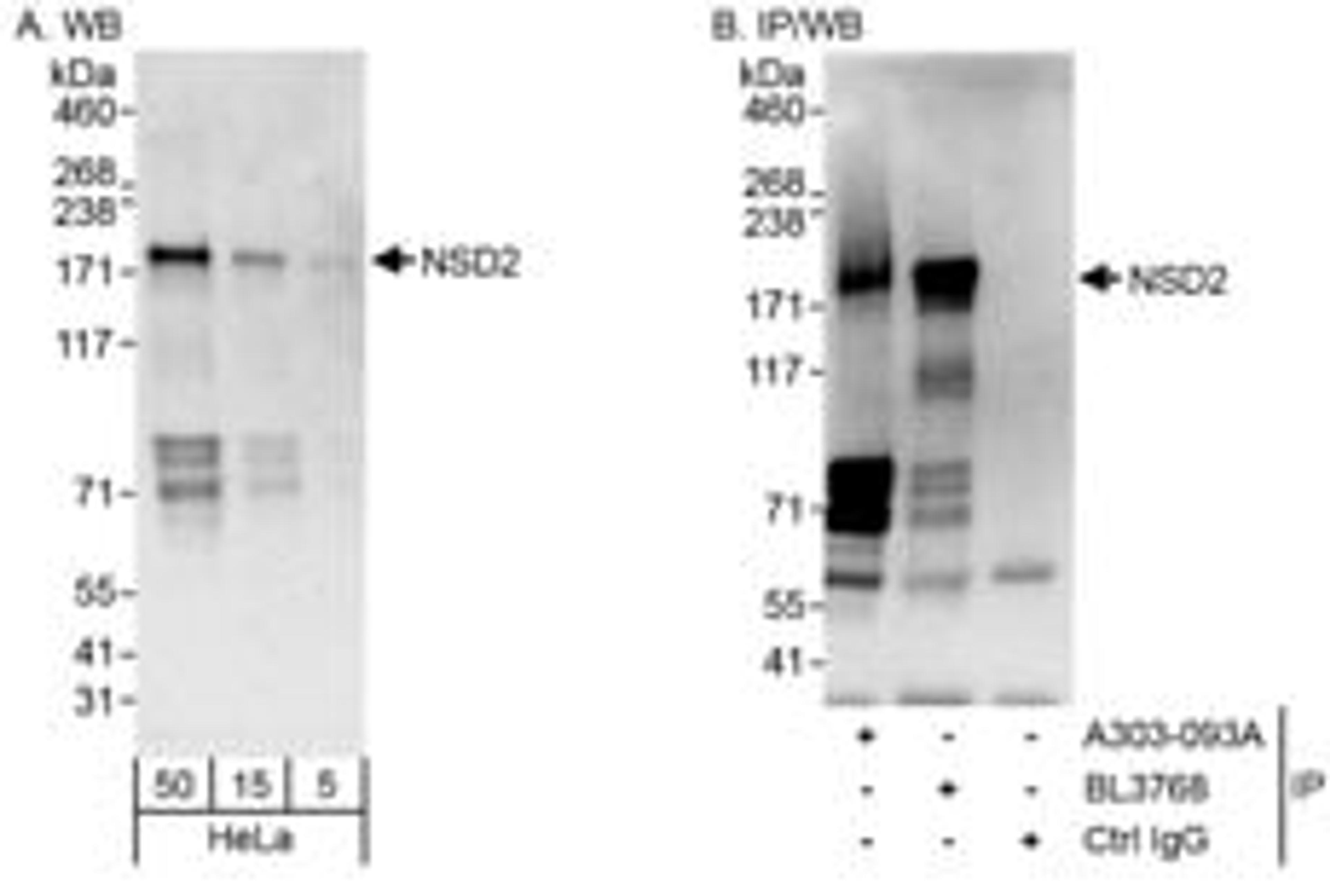 Detection of human NSD2 by western blot and immunoprecipitation.