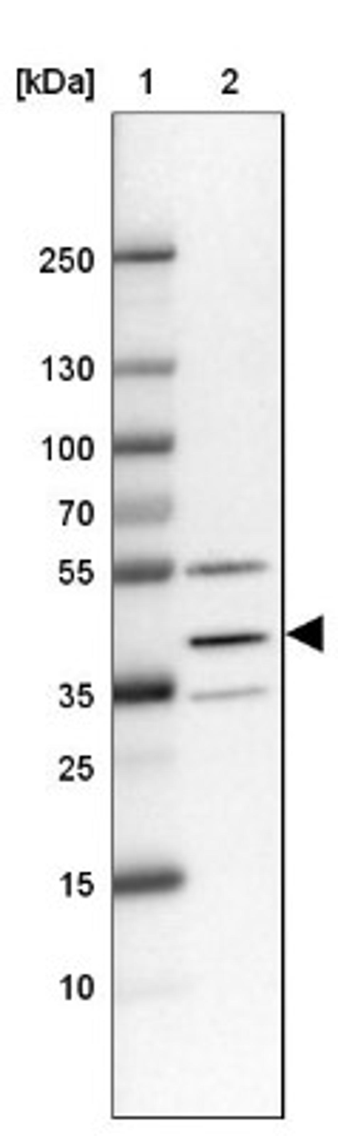 Western Blot: TMEM116 Antibody [NBP1-81881] - Lane 1: Marker [kDa] 250, 130, 100, 70, 55, 35, 25, 15, 10<br/>Lane 2: RT-4