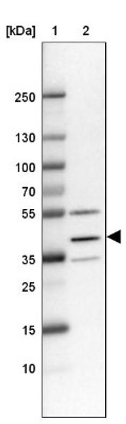 Western Blot: TMEM116 Antibody [NBP1-81881] - Lane 1: Marker [kDa] 250, 130, 100, 70, 55, 35, 25, 15, 10<br/>Lane 2: RT-4