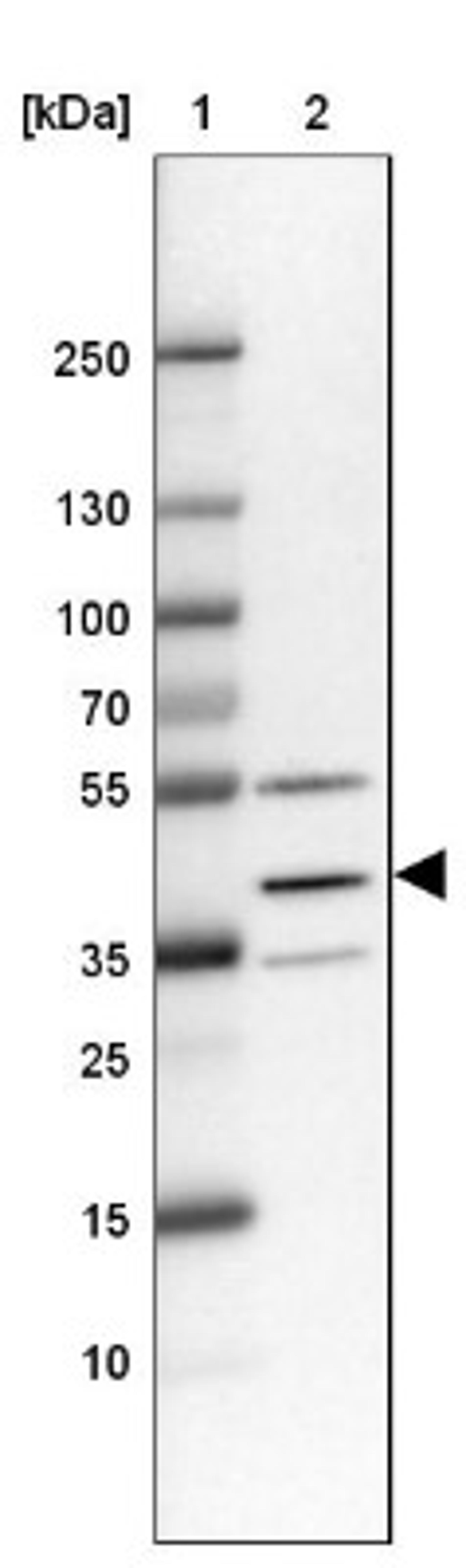 Western Blot: TMEM116 Antibody [NBP1-81881] - Lane 1: Marker [kDa] 250, 130, 100, 70, 55, 35, 25, 15, 10<br/>Lane 2: RT-4