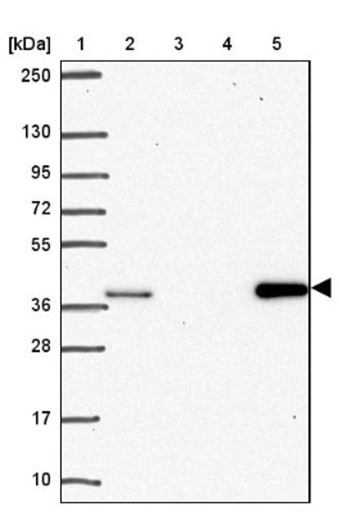 Western Blot: AKR1D1 Antibody [NBP2-33811] - Lane 1: Marker [kDa] 250, 130, 95, 72, 55, 36, 28, 17, 10<br/>Lane 2: Human cell line RT-4<br/>Lane 3: Human cell line U-251MG sp<br/>Lane 4: Human plasma (IgG/HSA depleted)<br/>Lane 5: Human liver tissue