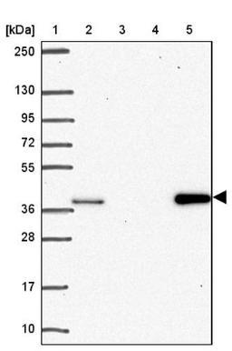 Western Blot: AKR1D1 Antibody [NBP2-33811] - Lane 1: Marker [kDa] 250, 130, 95, 72, 55, 36, 28, 17, 10<br/>Lane 2: Human cell line RT-4<br/>Lane 3: Human cell line U-251MG sp<br/>Lane 4: Human plasma (IgG/HSA depleted)<br/>Lane 5: Human liver tissue