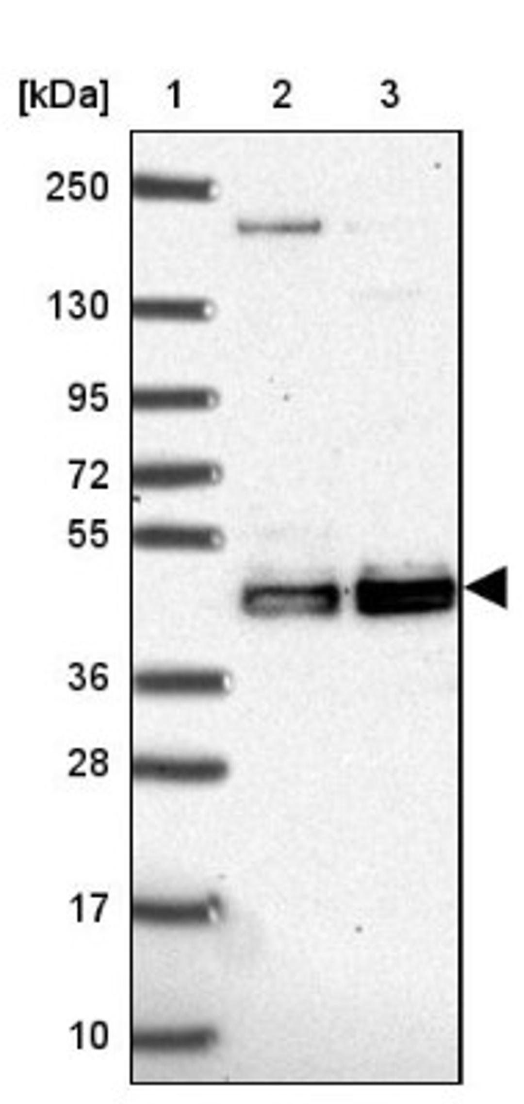 Western Blot: CLP1 Antibody [NBP2-33847] - Lane 1: Marker [kDa] 250, 130, 95, 72, 55, 36, 28, 17, 10<br/>Lane 2: Human cell line RT-4<br/>Lane 3: Human cell line U-251MG sp