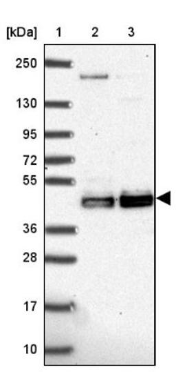 Western Blot: CLP1 Antibody [NBP2-33847] - Lane 1: Marker [kDa] 250, 130, 95, 72, 55, 36, 28, 17, 10<br/>Lane 2: Human cell line RT-4<br/>Lane 3: Human cell line U-251MG sp