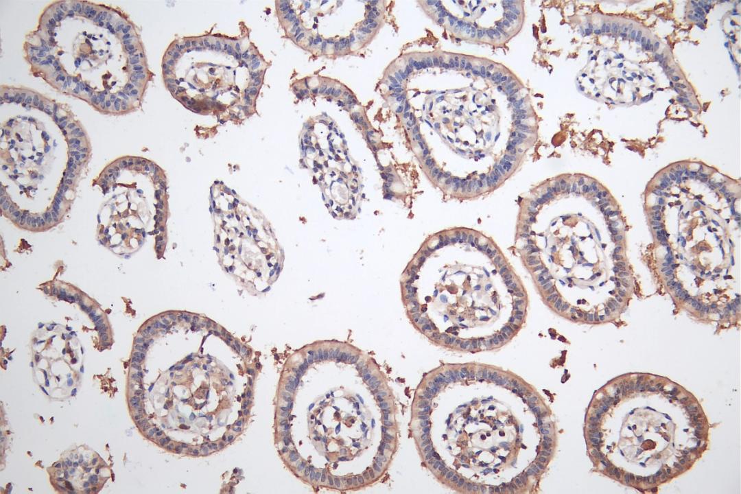 IHC image of CSB-PA883443ESR2HU diluted at 1:50 and staining in paraffin-embedded human Small intestine tissue performed on a Leica BondTM system. After dewaxing and hydration, antigen retrieval was mediated by high pressure in a citrate buffer (pH 6.0). Section was blocked with 10% normal goat serum 30min at RT. Then primary antibody (1% BSA) was incubated at 4°C overnight. The primary is detected by a Goat anti-rabbit polymer IgG labeled by HRP and visualized using 0.05% DAB.