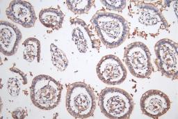 IHC image of CSB-PA883443ESR2HU diluted at 1:50 and staining in paraffin-embedded human Small intestine tissue performed on a Leica BondTM system. After dewaxing and hydration, antigen retrieval was mediated by high pressure in a citrate buffer (pH 6.0). Section was blocked with 10% normal goat serum 30min at RT. Then primary antibody (1% BSA) was incubated at 4°C overnight. The primary is detected by a Goat anti-rabbit polymer IgG labeled by HRP and visualized using 0.05% DAB.
