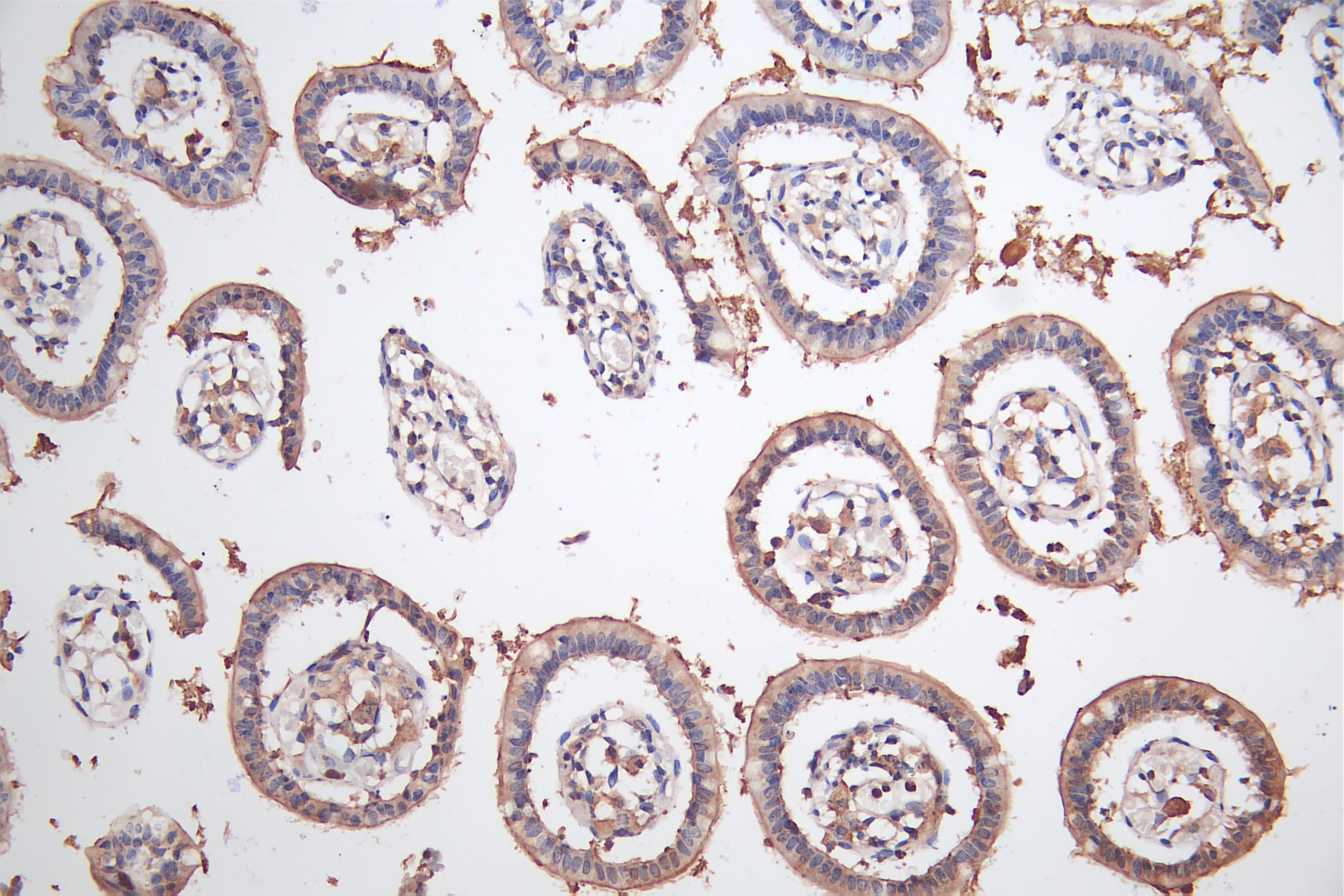 IHC image of CSB-PA883443ESR2HU diluted at 1:50 and staining in paraffin-embedded human Small intestine tissue performed on a Leica BondTM system. After dewaxing and hydration, antigen retrieval was mediated by high pressure in a citrate buffer (pH 6.0). Section was blocked with 10% normal goat serum 30min at RT. Then primary antibody (1% BSA) was incubated at 4°C overnight. The primary is detected by a Goat anti-rabbit polymer IgG labeled by HRP and visualized using 0.05% DAB.
