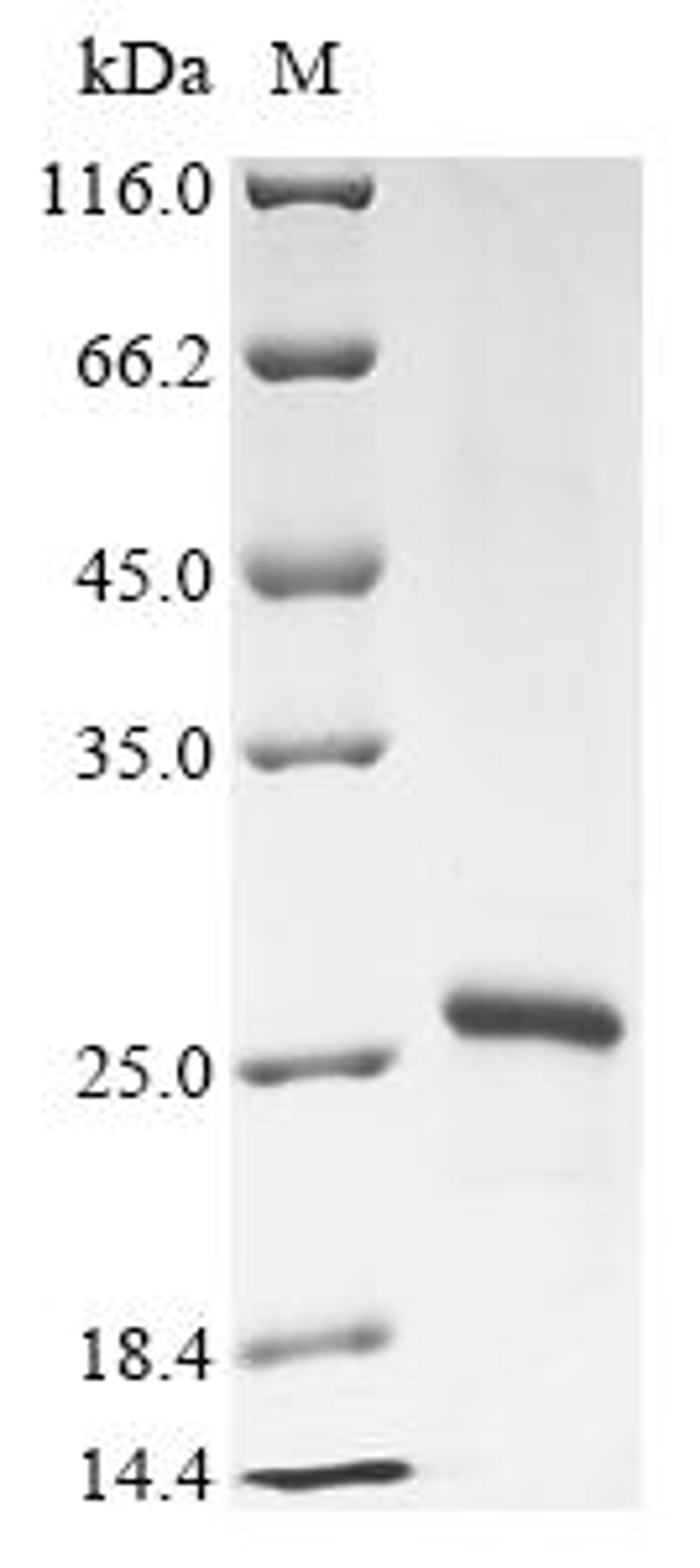 (Tris-Glycine gel) Discontinuous SDS-PAGE (reduced) with 5% enrichment gel and 15% separation gel.