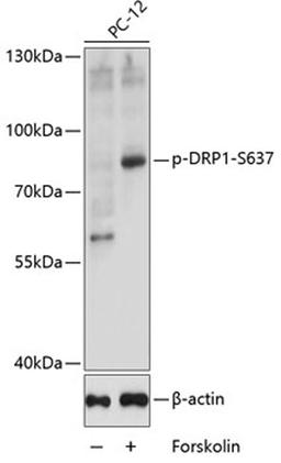 Western blot - Phospho-DRP1-S637 antibody (AP0812)