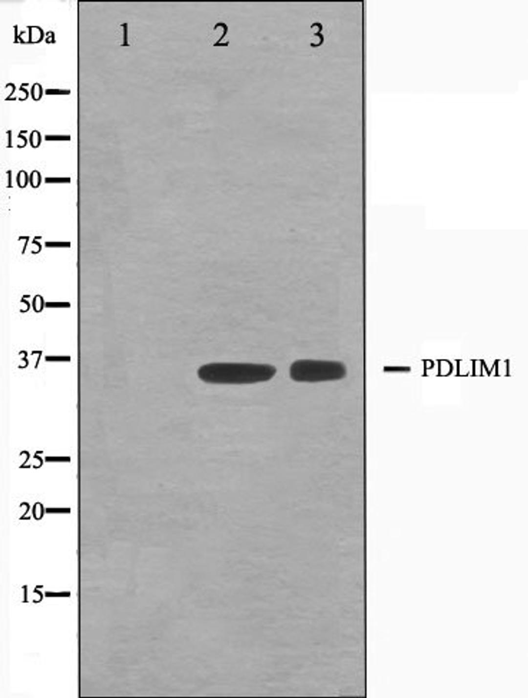 Western blot analysis of K562 and Jurkat cell lysate using CLIM1 antibody