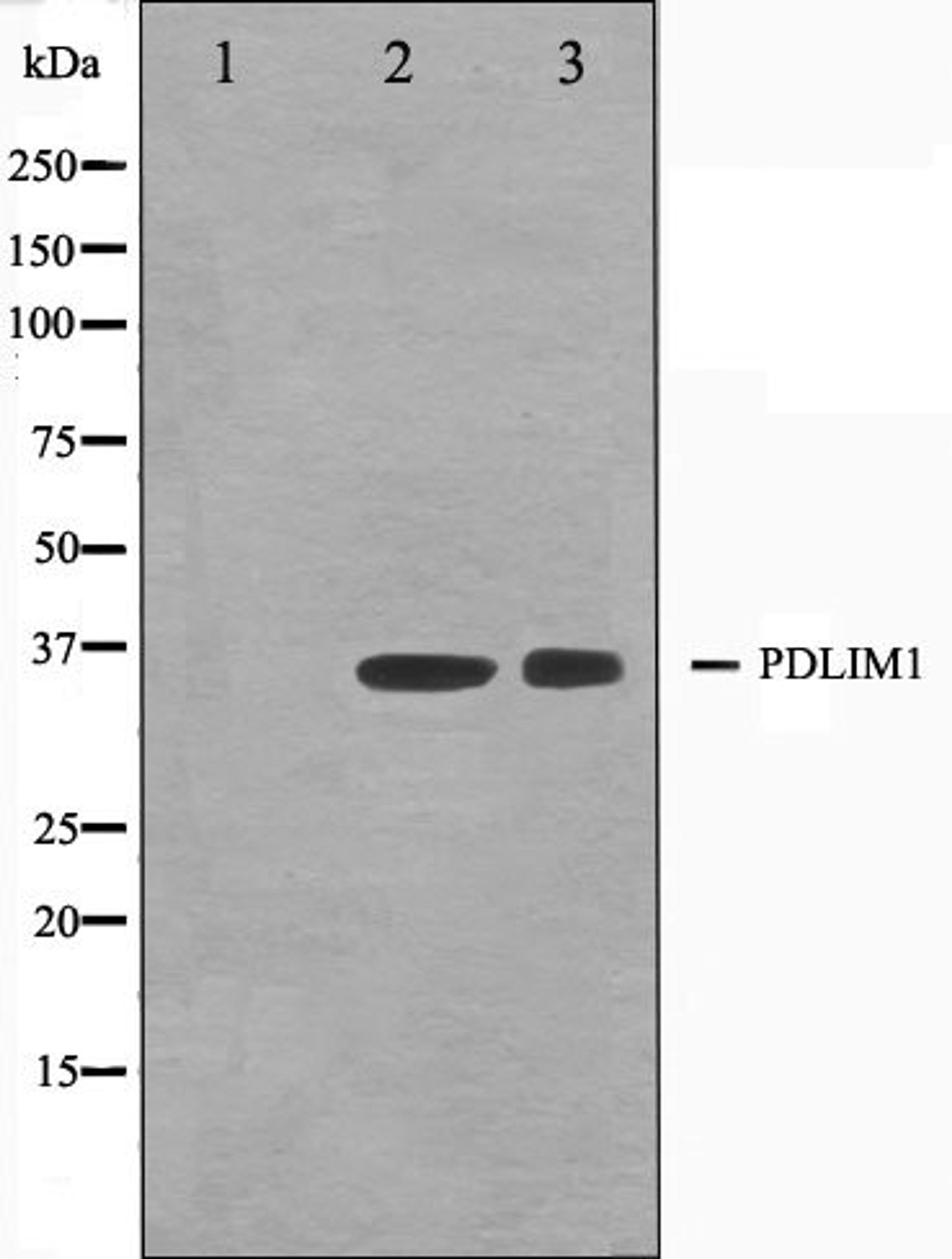 Western blot analysis of K562 and Jurkat cell lysate using CLIM1 antibody