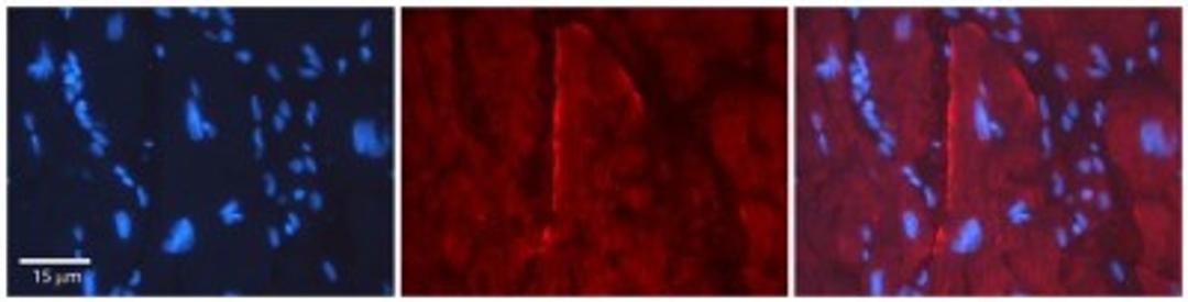 Immunohistochemistry: GJC2 Antibody [NBP1-59263] - Human Adult heart Observed Staining: Membrane, some cytoplasm Primary Antibody Concentration: 1 : 100 Secondary Antibody: Donkey anti-Rabbit-Cy2/3 Secondary Antibody Concentration: 1 : 200 Magnification: 20X Exposure Time: 0.5 2.0 sec.