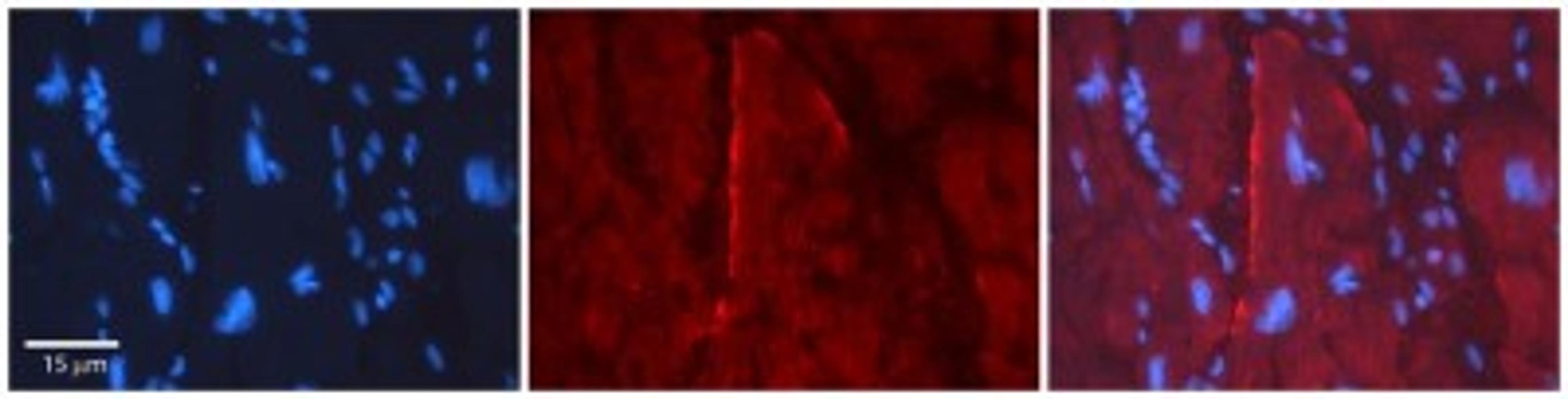 Immunohistochemistry: GJC2 Antibody [NBP1-59263] - Human Adult heart Observed Staining: Membrane, some cytoplasm Primary Antibody Concentration: 1 : 100 Secondary Antibody: Donkey anti-Rabbit-Cy2/3 Secondary Antibody Concentration: 1 : 200 Magnification: 20X Exposure Time: 0.5 2.0 sec.