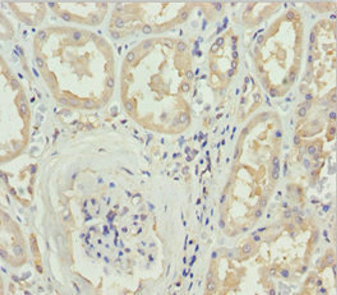 Immunohistochemistry of paraffin-embedded human kidney tissue using CSB-PA836734ESR1HU at dilution of 1:100