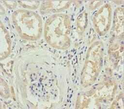 Immunohistochemistry of paraffin-embedded human kidney tissue using CSB-PA836734ESR1HU at dilution of 1:100