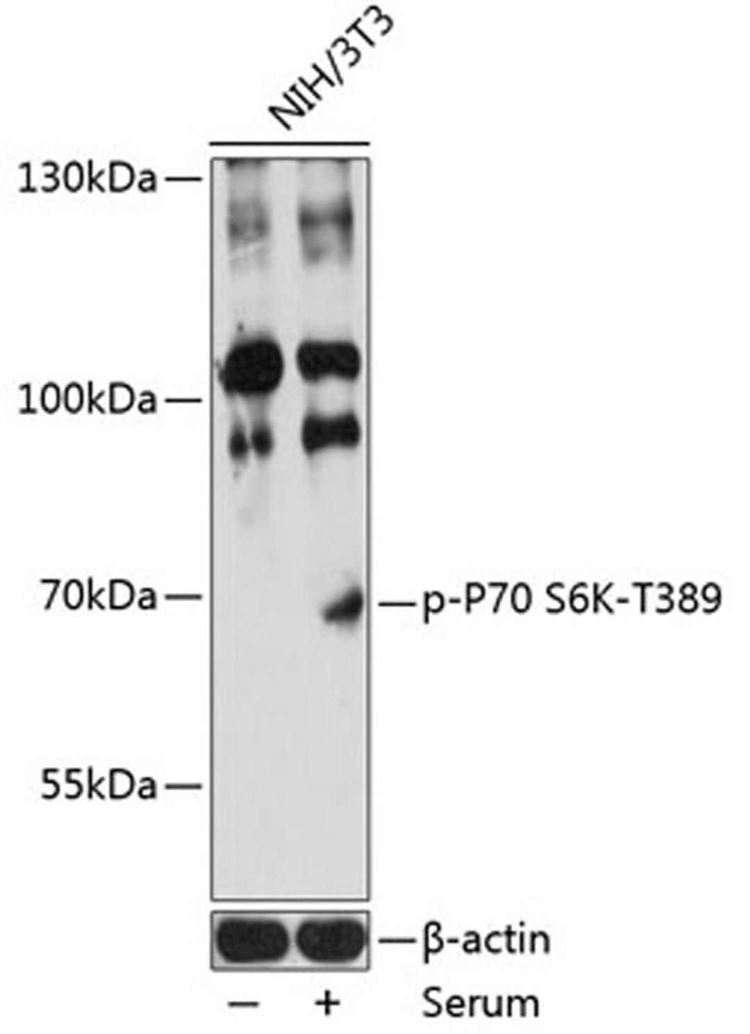 Western blot - Phospho-P70 S6K-T389 antibody (AP0564)