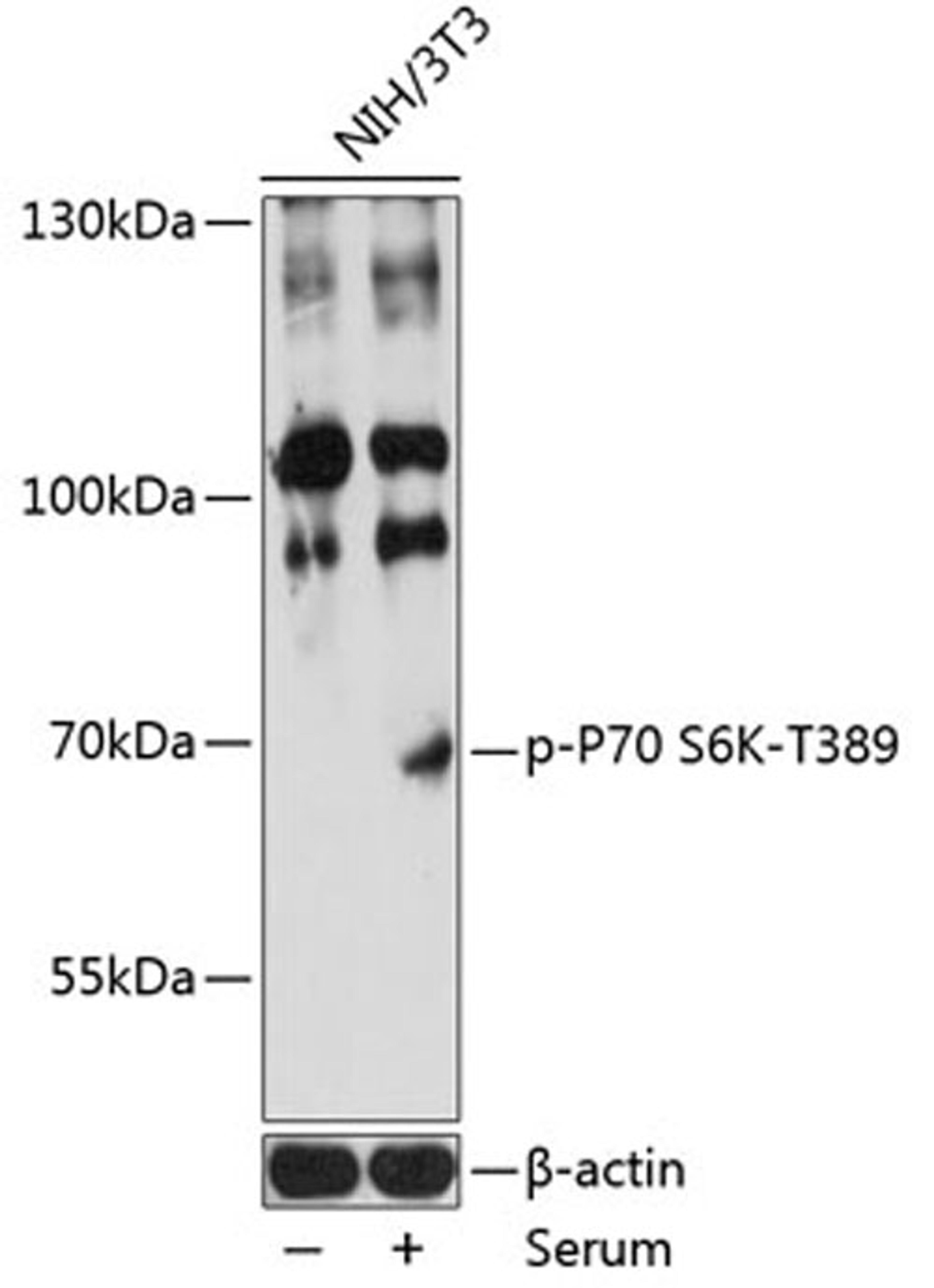 Western blot - Phospho-P70 S6K-T389 antibody (AP0564)