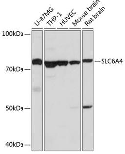 Western blot - SLC6A4 Polyclonal Antibody (A14171)