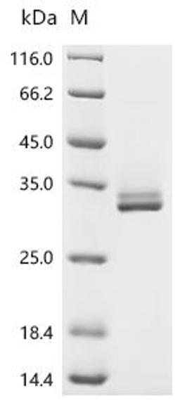 (Tris-Glycine gel) Discontinuous SDS-PAGE (reduced) with 5% enrichment gel and 15% separation gel.