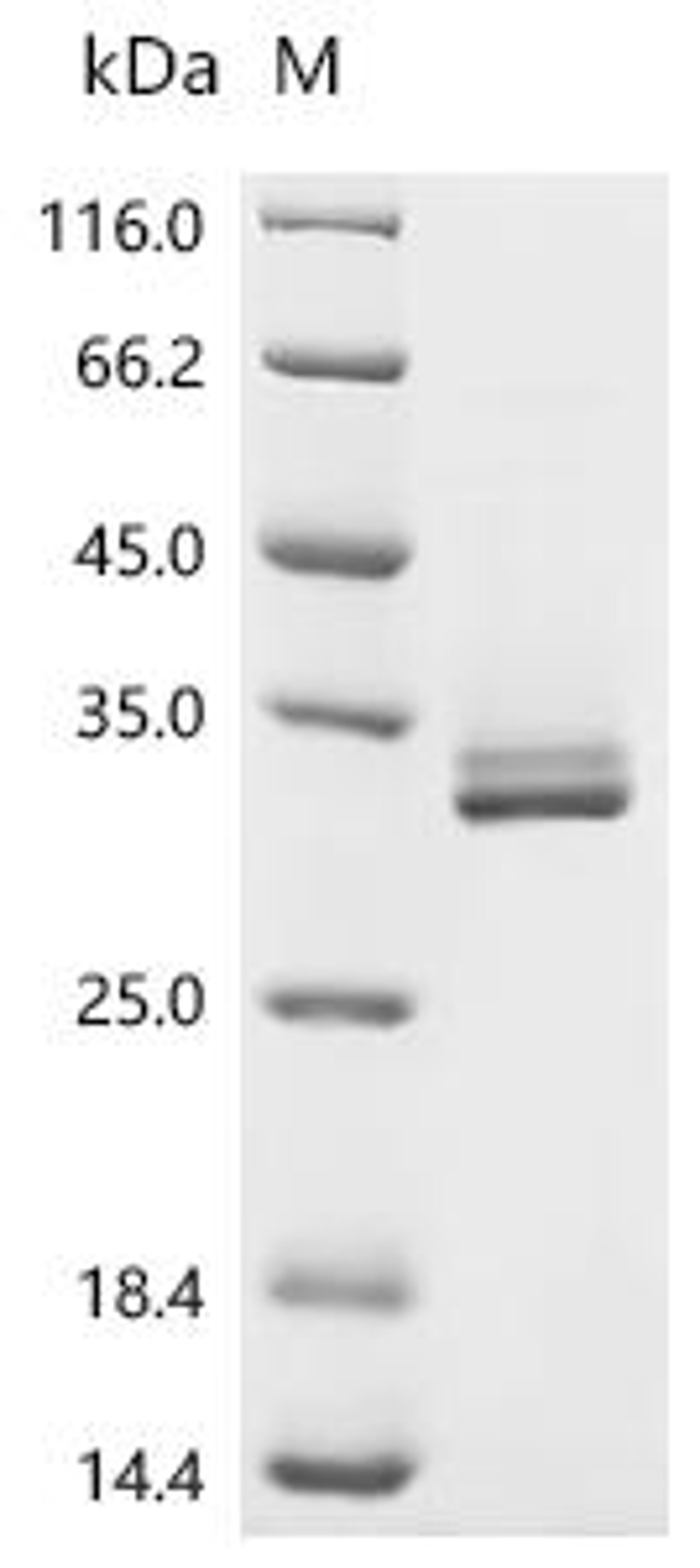 (Tris-Glycine gel) Discontinuous SDS-PAGE (reduced) with 5% enrichment gel and 15% separation gel.