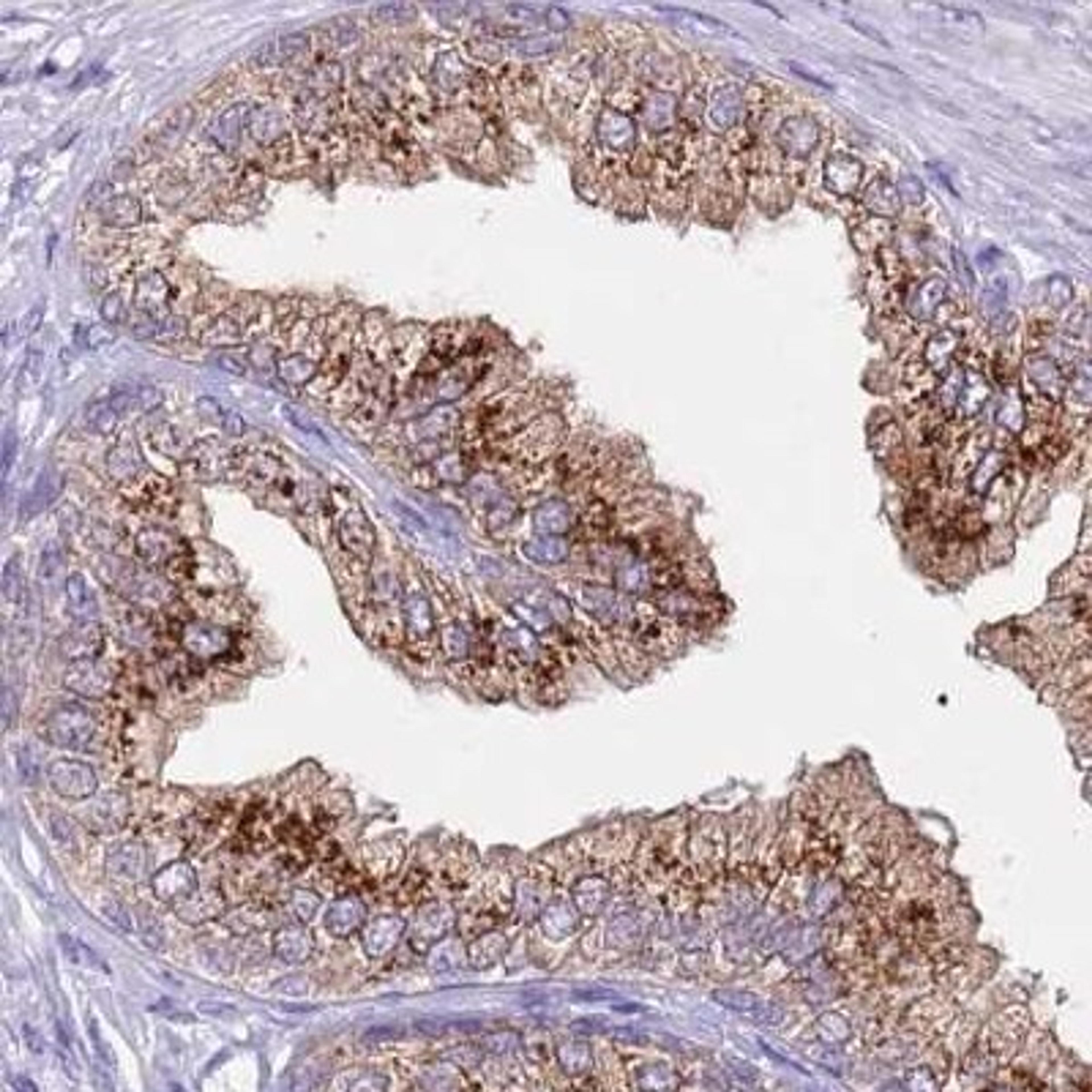 Immunohistochemistry: MYCT1 Antibody [NBP2-32059] - Staining of human prostate shows strong cytoplasmic positivity in glandular cells.