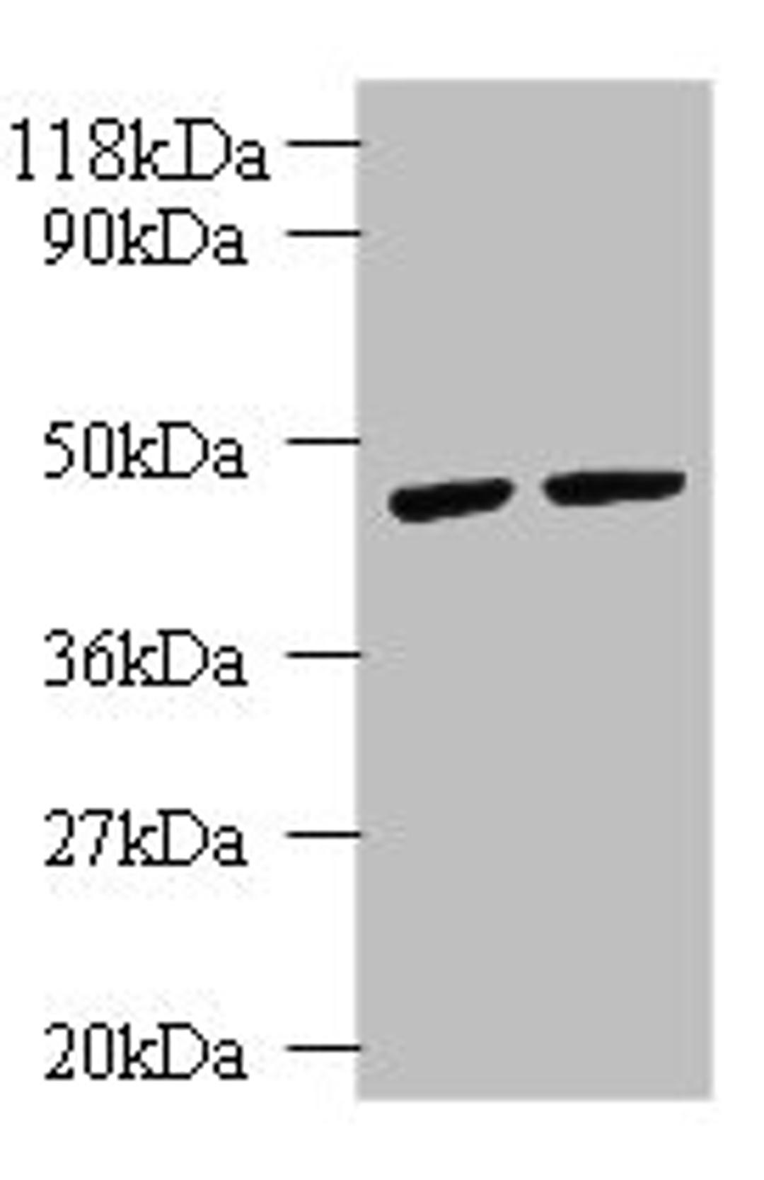 Western blot. All lanes: KRT18 antibody at 2µg/ml. Lane 1: K562 whole cell lysate. Lane 2: HepG2 whole cell lysate. Secondary. Goat polyclonal to rabbit IgG at 1/10000 dilution. Predicted band size: 49 kDa. Observed band size: 49 kDa