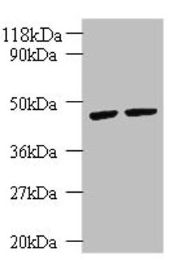 Western blot. All lanes: KRT18 antibody at 2µg/ml. Lane 1: K562 whole cell lysate. Lane 2: HepG2 whole cell lysate. Secondary. Goat polyclonal to rabbit IgG at 1/10000 dilution. Predicted band size: 49 kDa. Observed band size: 49 kDa