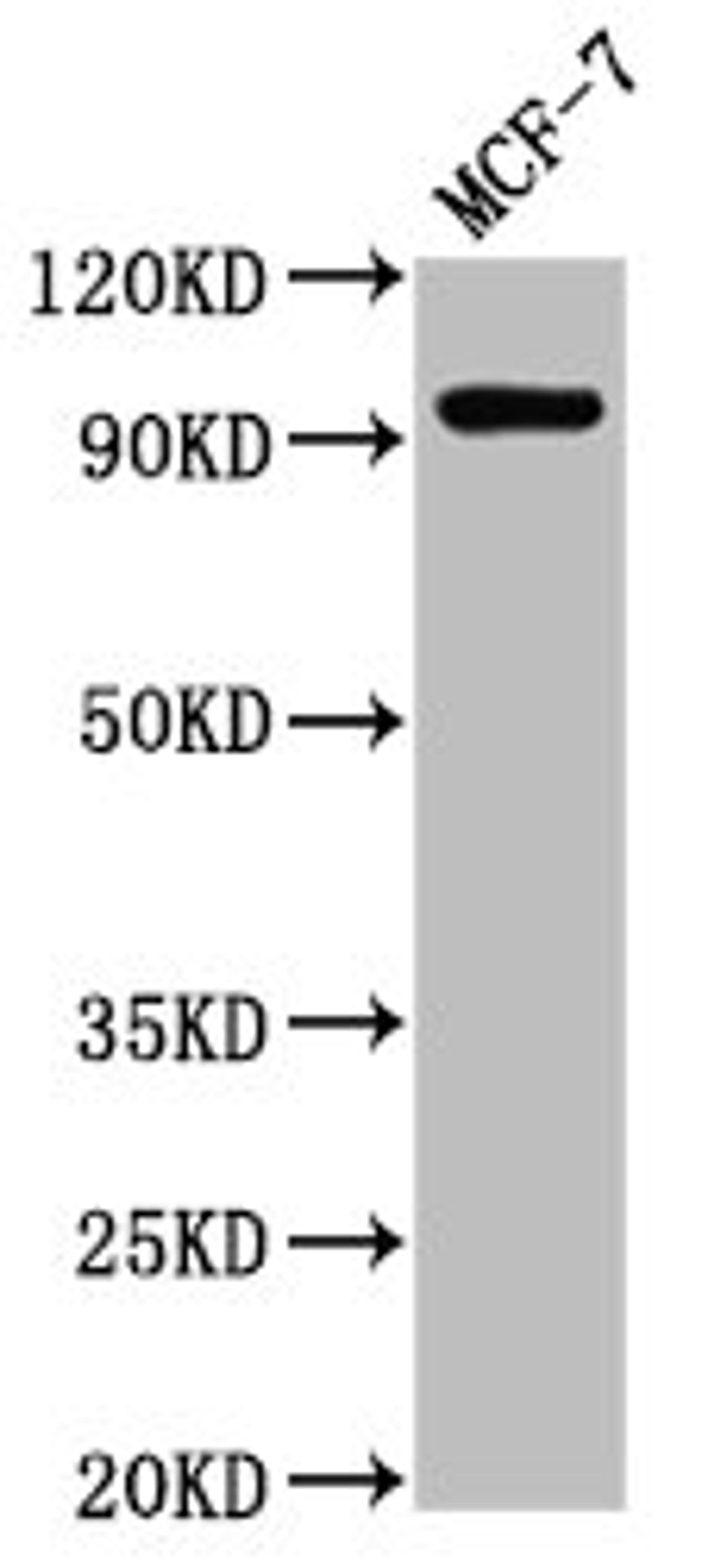 Western Blot. Positive WB detected in: MCF-7 whole cell lysate. All lanes: NCAM2 antibody at 2.7ug/ml. Secondary. Goat polyclonal to rabbit IgG at 1/50000 dilution. Predicted band size: 94, 48 kDa. Observed band size: 94 kDa. 