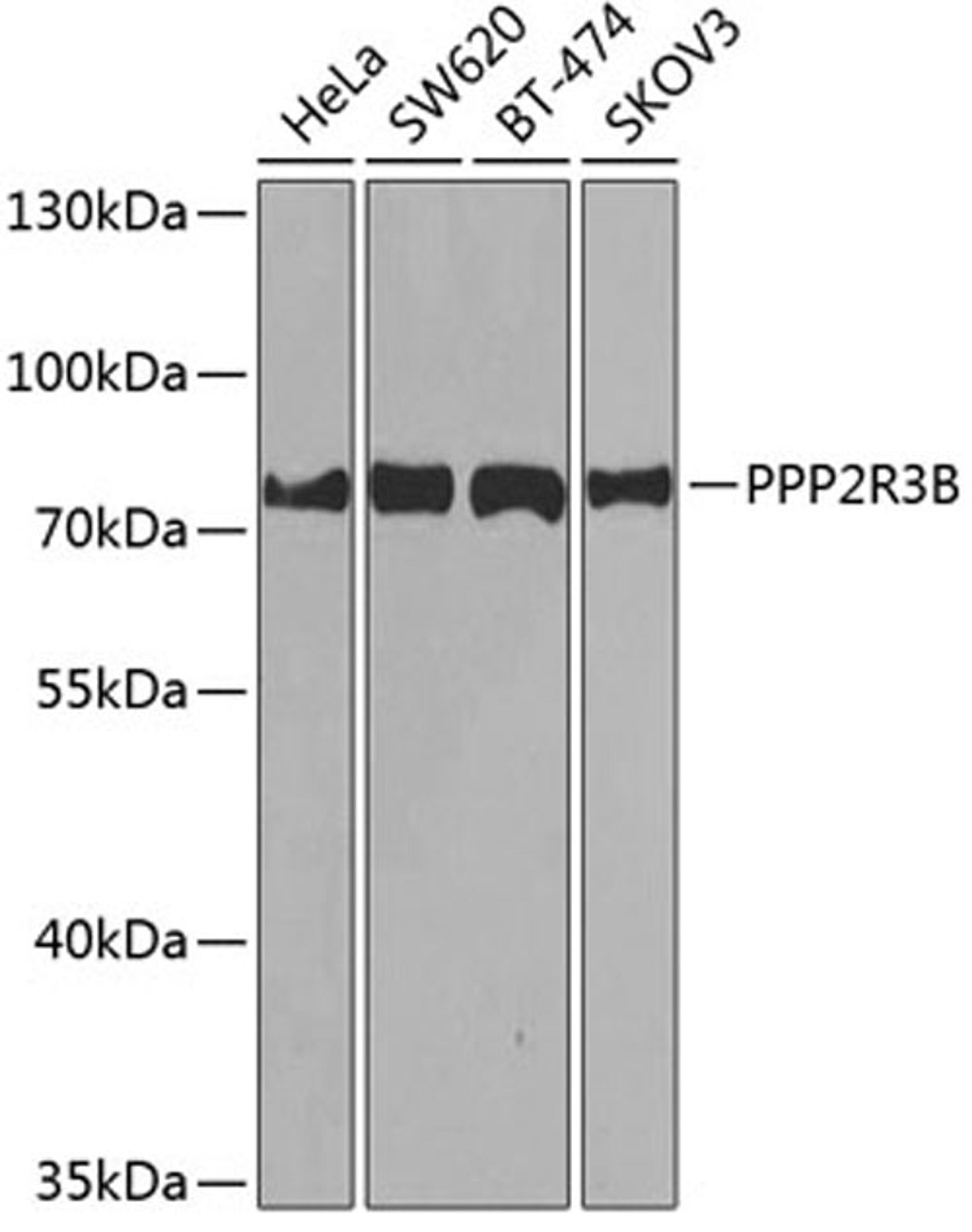 Western blot - PPP2R3B antibody (A8489)