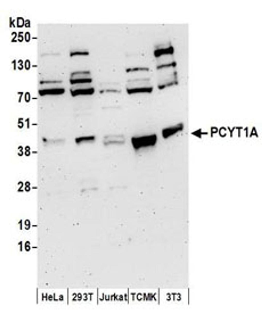 Detection of human and mouse PCYT1A by western blot.