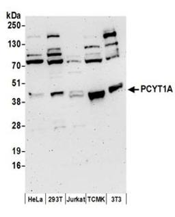 Detection of human and mouse PCYT1A by western blot.