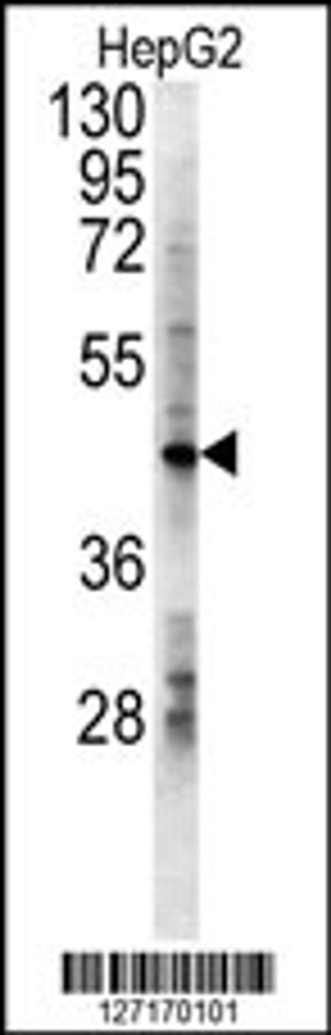 Western blot analysis in HepG2 cell line lysates (15ug/lane).