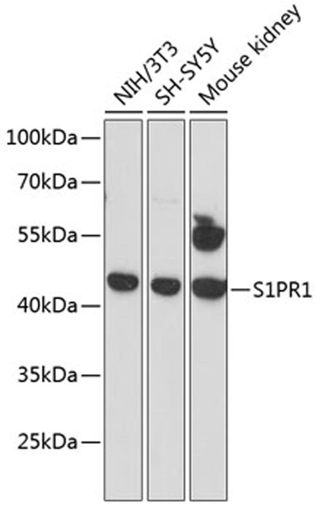 Western blot - S1PR1 antibody (A12935)