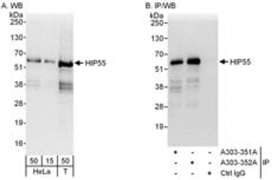 Detection of human HIP55 by western blot and immunoprecipitation.