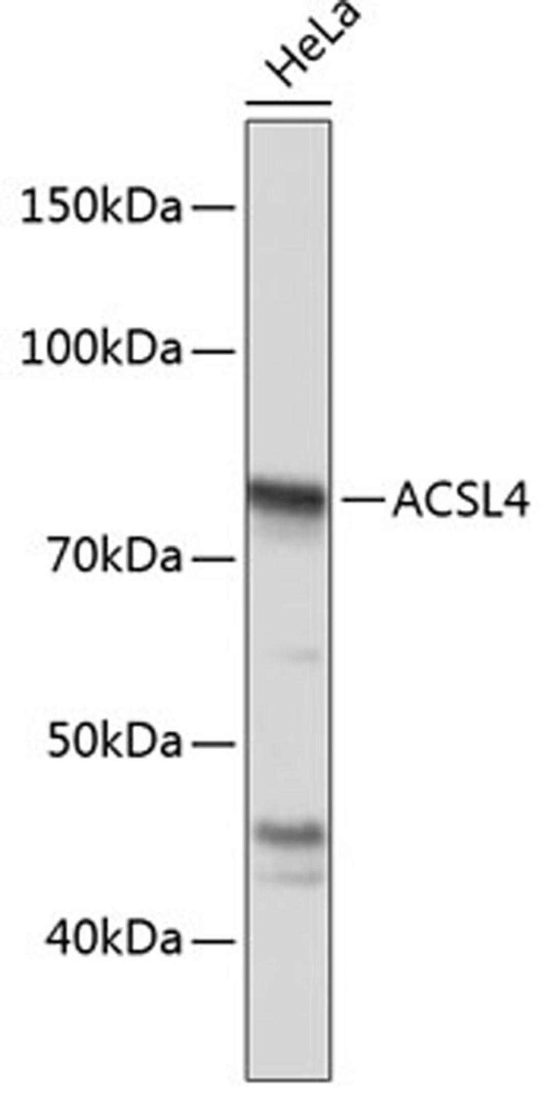 Western blot - ACSL4 Polyclonal Antibody (A6826)