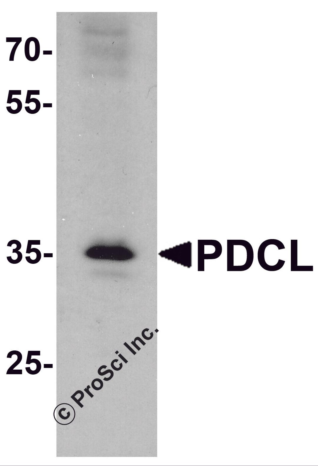 Western blot analysis of PDCL in K562 cell lysate with PDCL antibody at 1 μg/ml.